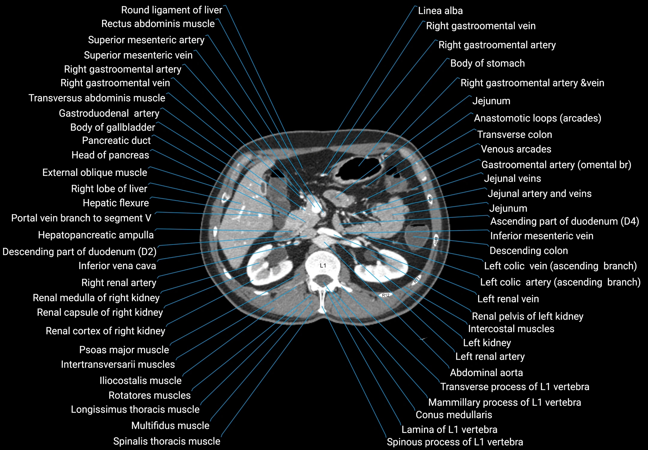 CT male pelvis axial cross sectional anatomy labelled radiology image -00061.webp
